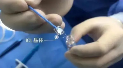 變身謠言“粉碎機(jī)”！濰坊眼科醫(yī)院?jiǎn)T工集體ICL晶體植入摘鏡直播圓滿(mǎn)完成