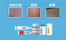 祛痘藥哪個(gè)好用？七味姜黃搽劑憑實(shí)力“出圈”，祛痘又猛又柔！