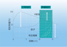 質(zhì)子治療兒童腫瘤一文詳解！